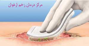 دبریدمان اتولیتیک